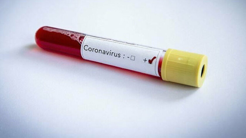 Kosova’da koronavirüs vaka sayısı 88’e yükseldi