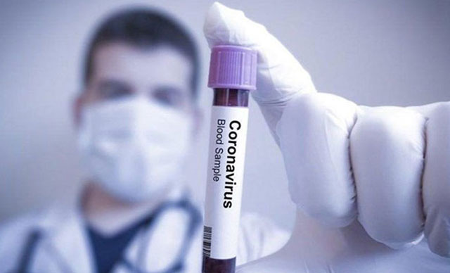 Bulgaristan’da koronavirüsten ölenlerin sayısı 10’a yükseldi
