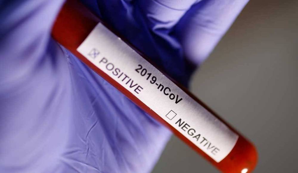 Yunanistan’da koronavirüs vaka sayısı 2.716’ya ulaştı