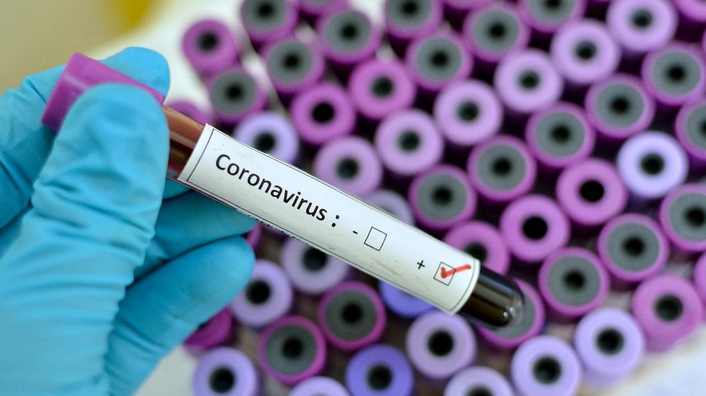 Bulgaristan’da koronavirüs vaka sayısı 1618’e yükseldi