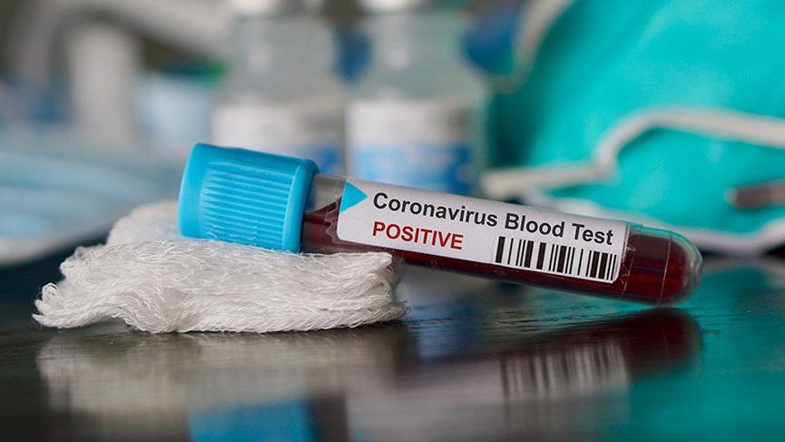 Bulgaristan’da koronavirüs vaka sayısı rekor seviyeye ulaştı