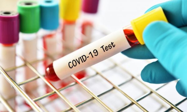 Kosova’da koronavirüs vaka sayısı 6.467’ye yükseldi