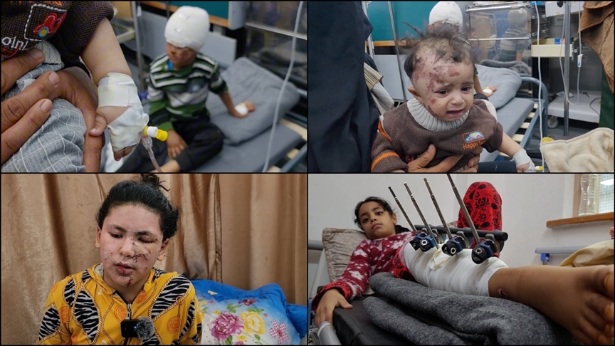 Gazze’de, İsrail’in saldırılarında yaralanan Filistinli çocuklar çektikleri acıyı anlattı