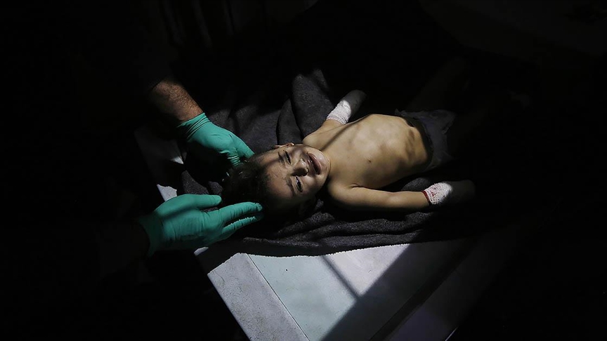 UNICEF, Gazze’deki çocuklar aşılarını kaçırma riskiyle karşı karşıya