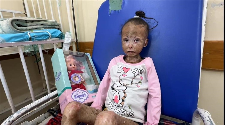 Gazzeli küçük kız çocuğu, hastalık, açlık ve susuzluğa karşı hayatta kalma mücadelesi veriyor