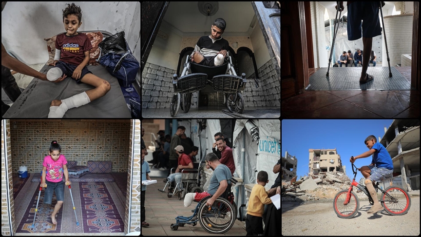 Gazze’deki Sağlık Bakanlığı: İsrail saldırılarında uzuvlarını kaybeden 6 bin kişi çok zor koşullar altında